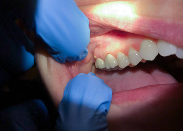 Best Tooth Pain Emergency Relief  in Bradford Woods, PA